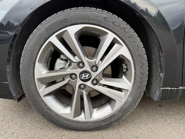 2017 Hyundai ELANTRA Limited 2.0L Auto (Alabama) *Ltd Avail*